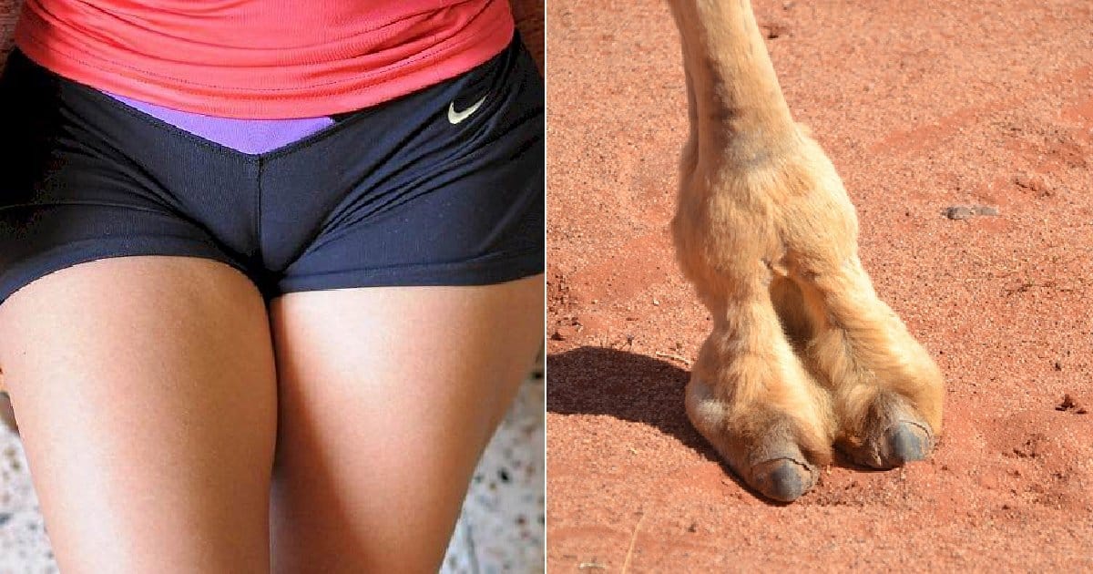 camel-toe-1.jpg