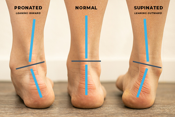 pronate-supinate-diagram_1_.jpeg