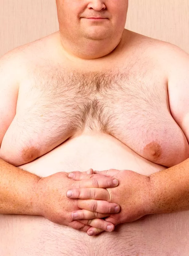 1_Obese-mans-naked-torso.jpg