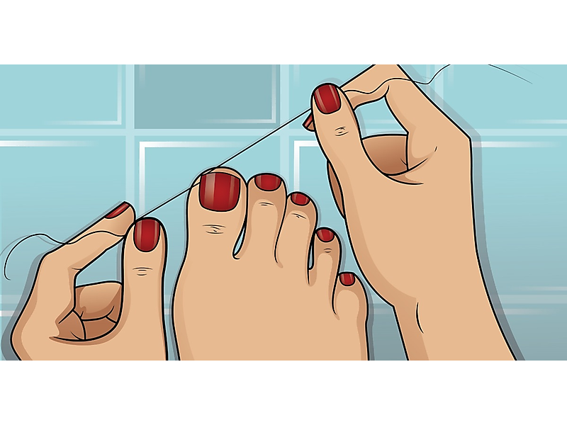 If You Have Toenail Fungus Try This at Home (It's Genius!)