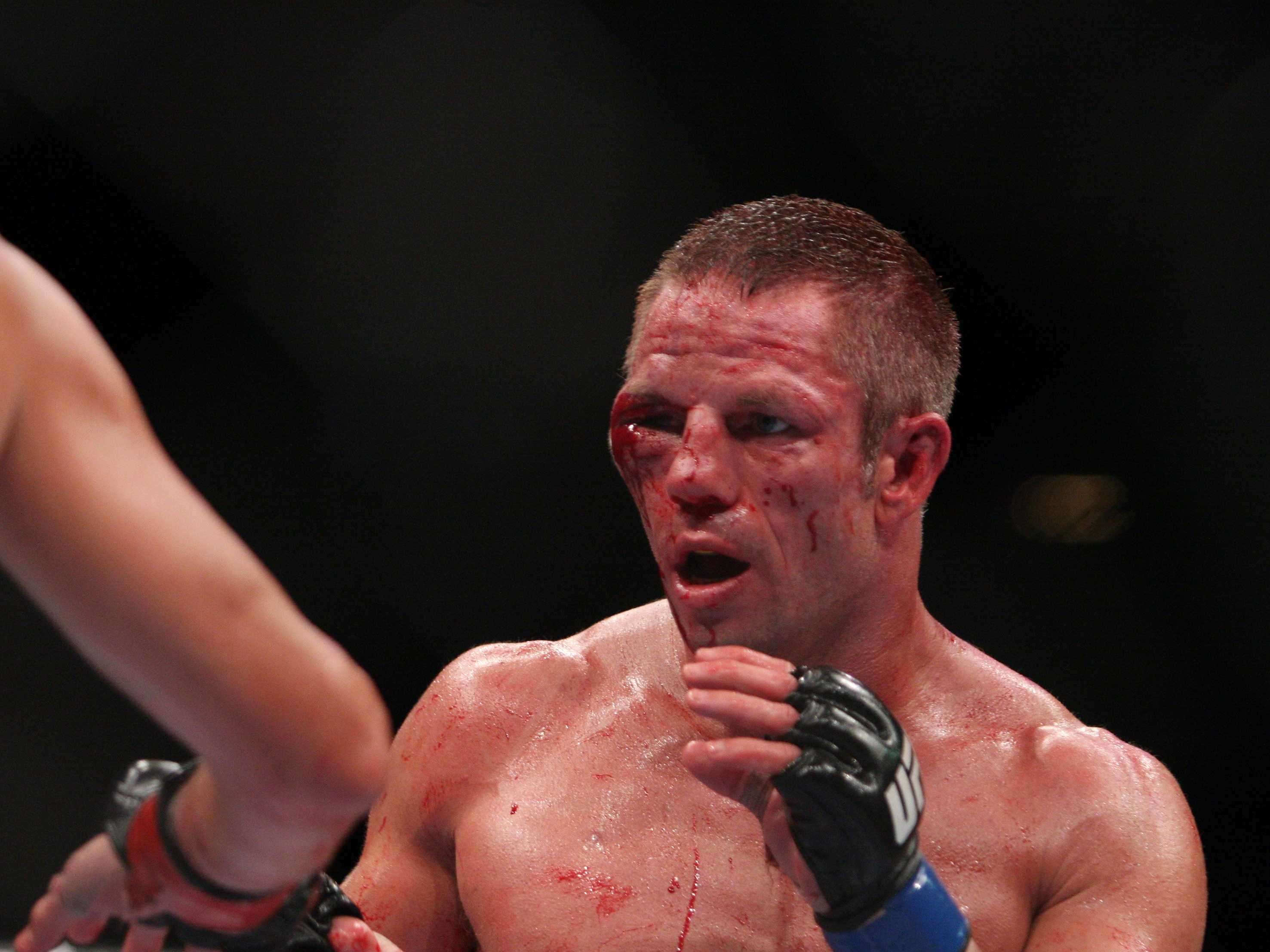 Marcus-Davis-after-fighting-Nate-Diaz.jpg