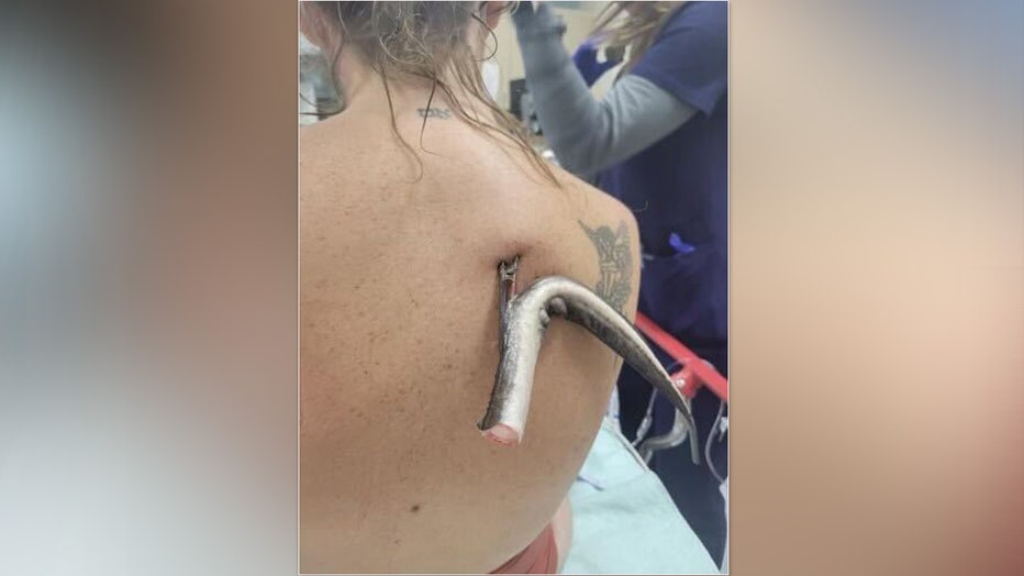 The stingray barb was 4 inches inside Kristie O'Brien's back. 