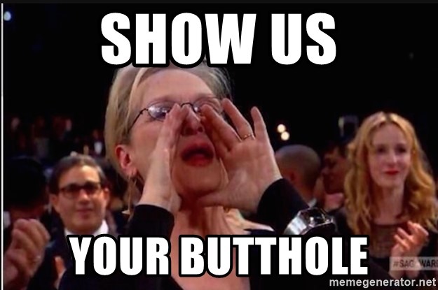 show-us-your-butthole.jpg