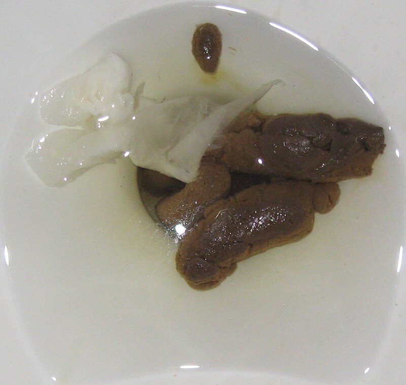 800px-Human_feces_in_toilet.jpg